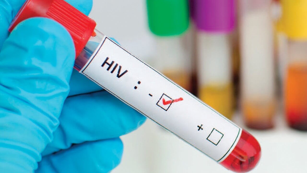 Virus тест. ВИЧ. ВИЧ пробирка. Шприц для ВИЧ инфицированных. ВИЧ картинки.